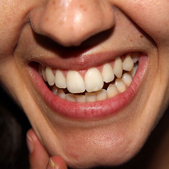 Union Hills Family Dental Care & Orthodontics -
