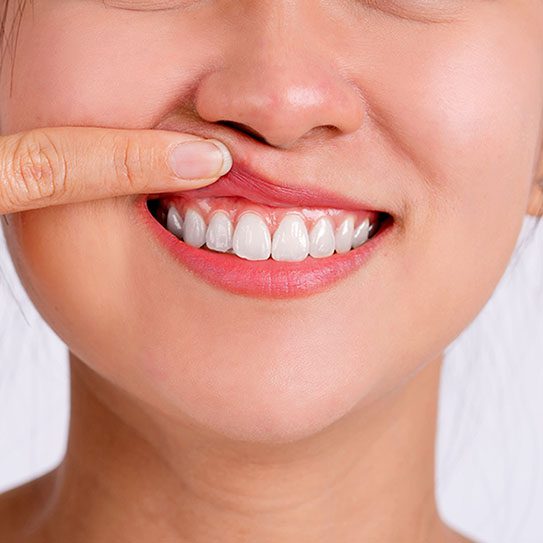 Union Hills Family Dental Care & Orthodontics -