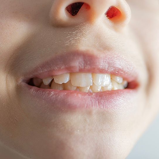Union Hills Family Dental Care & Orthodontics -